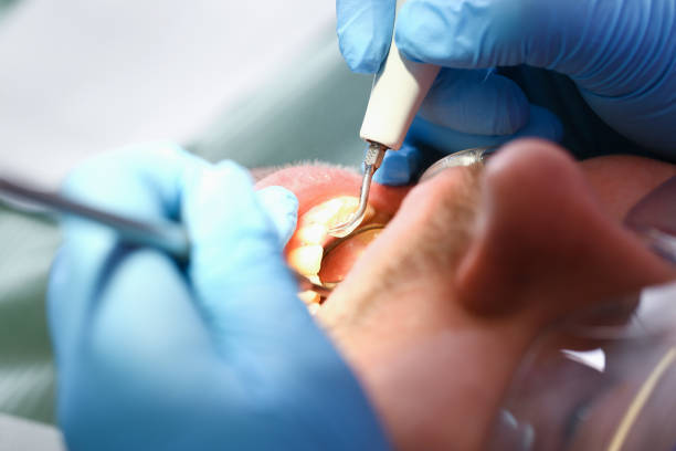 Best Pediatric Emergency Dentist in Clay, CA