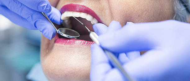 Best Emergency Dentist for Knocked-Out Tooth in Clay, CA